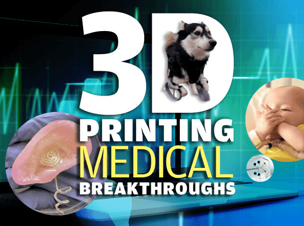 3D MEDICAL PRINTING